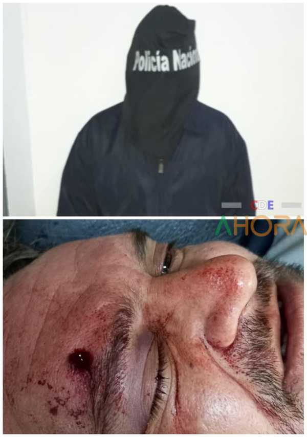 Detienen a SEGURIDAD que DISPARO contra un URUGUAYO