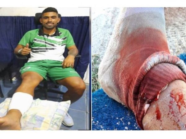 Ligó corte de 25 puntos y su rival, ¡ni amarilla!
