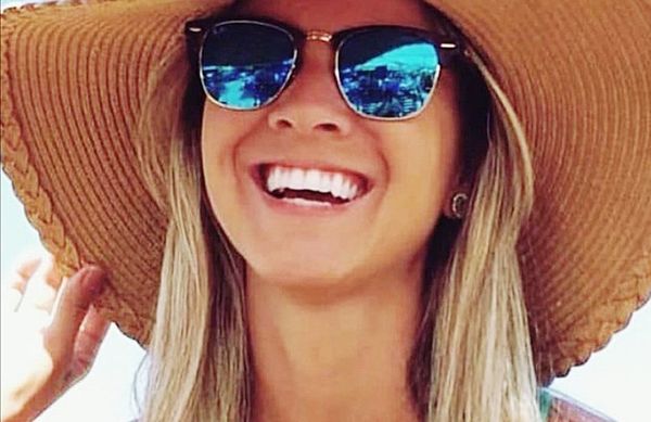 Accesorios must have del verano - Nacionales - ABC Color