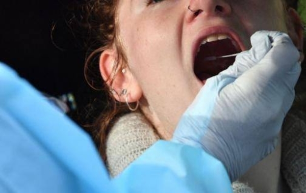 HOY / Lesiones en la lengua y manchas en pies y manos podrían ser síntomas del COVID-19