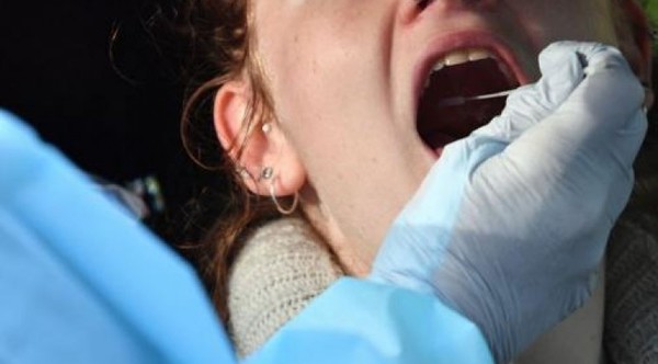 Lesiones en la lengua y manchas en pies y manos podrían ser síntomas del COVID-19