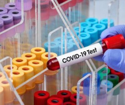Nuevo récord de pacientes en UTI a causa del COVID