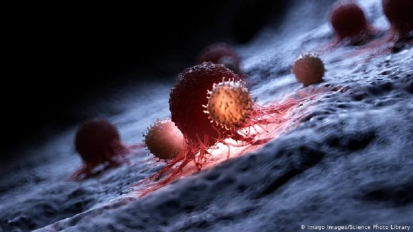 Estudio israelí avanza en caracterizar las células cancerosas