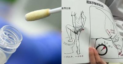 China empieza a hacer pruebas anales para detectar el coronavirus - Noticiero Paraguay
