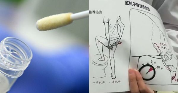 China empieza a hacer pruebas anales para detectar el coronavirus - Noticiero Paraguay