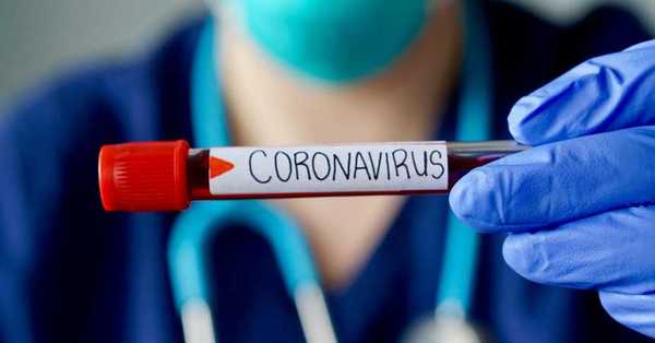 Brasil es el país que peor ha manejado la pandemia según estudio australiano - C9N