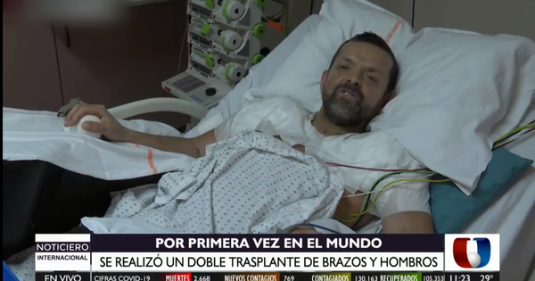 Francia realiza doble trasplante de brazos y hombros
