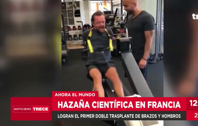 Paciente islandés recibió doble trasplante de brazos en Francia