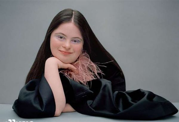 Ellie Goldstein, la primera modelo con síndrome de Down en la portada de la revista Elle