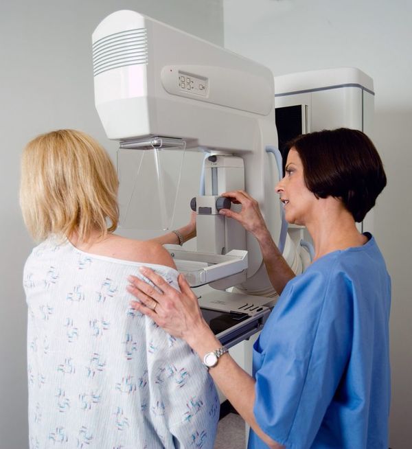 Cáncer de mama desplaza al de pulmón como el más común en el mundo - Mundo - ABC Color