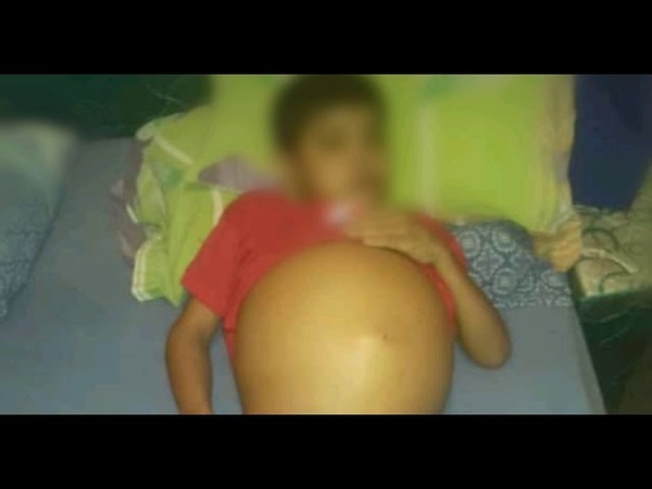 NIÑO ENCARNACENO REQUIERE DE TRASPLANTE DE HÍGADO*