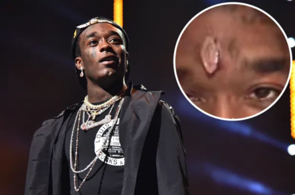 El rapero Lil Uzi Vert se implantó un diamante de US$ 24 millones en su frente