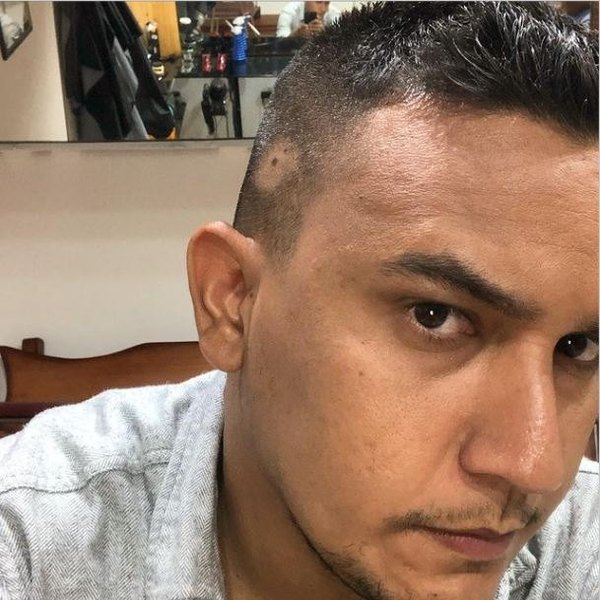 Crónica / Periodista se está quedando perê a causa del estrés