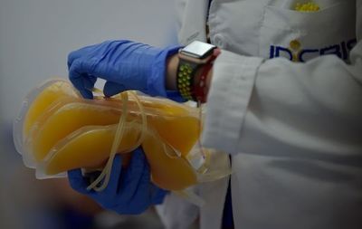 Paciente inmunodeprimido y tratado con plasma desarrolló variante del covid - Ciencia - ABC Color