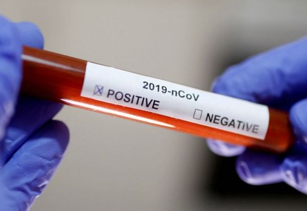 Covid suma 19 muertes y 515 nuevos contagios