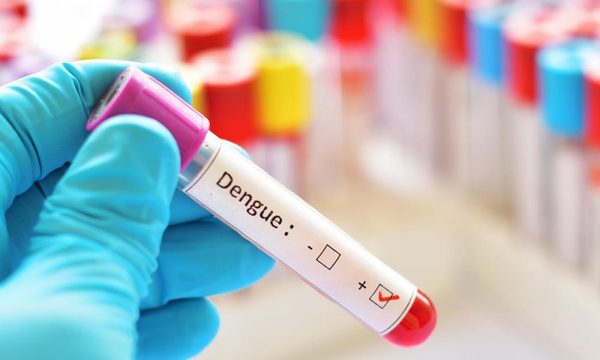 Paraguay reporta 62 casos de dengue y más de 2.200 notificaciones de la enfermedad – Diario TNPRESS