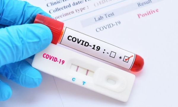 Salud reporta 827 nuevos casos y 20 muertos por coronavirus