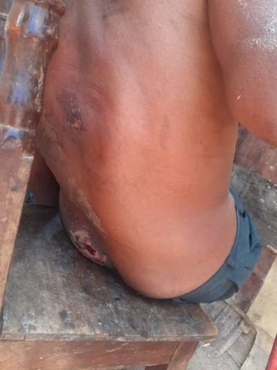 Limpio: Piden ayuda para un hombre abandonado por su familia y que quedó sin caminar | Ñanduti