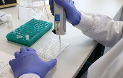 Las personas con síndrome de Down son genéticamente susceptibles a la covid - Ciencia - ABC Color