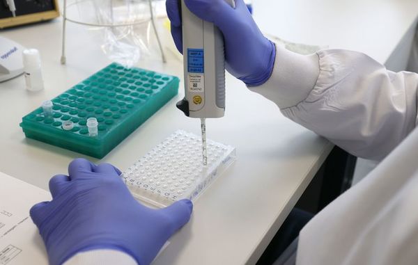 Las personas con síndrome de Down son genéticamente susceptibles a la covid - Ciencia - ABC Color