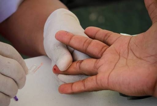 HOY / Reactivos para VIH y sífilis en stock crítico: Pronasida prioriza testeo a grupos específicos