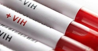La Nación / Aclaran que los test de detección del VIH se realizan con total normalidad