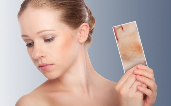 Dermatitis atópica y los cuidados de la piel