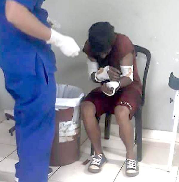 Drogadicto se prendió fuego dentro del calabozo tras ser detenido por guardias
