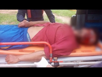 FALLECE HOMBRE QUE RECIBIÓ UN DISPARO EN LA BOCA EN SAN PEDRO DEL PARANÁ