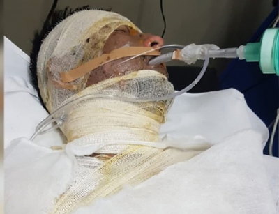 Muere el joven que se prendió fuego tras pelear con su pareja - Noticiero Paraguay