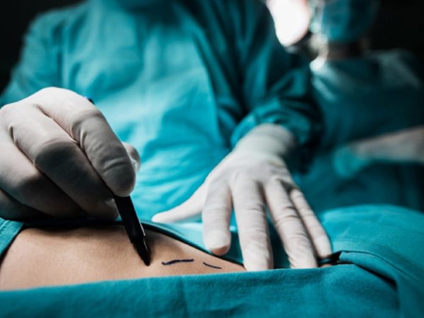 Mujer tuvo complicaciones tras cirugía a cargo de médico imputado