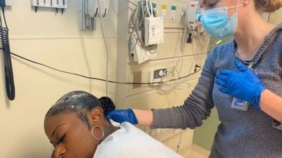Tras una operación de 4 horas logran retirar el pegamento Gorilla Glue