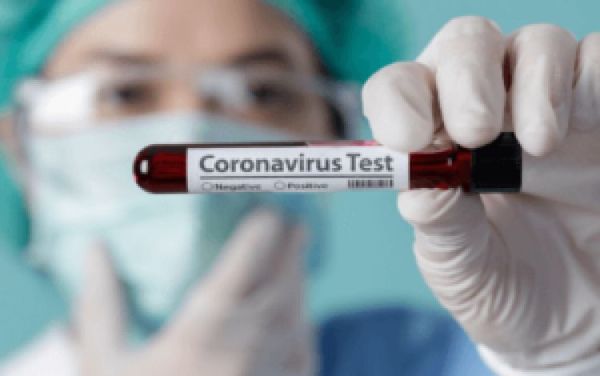 Salud detecta 1.053 nuevos contagios y 17 muertes por coronavirus