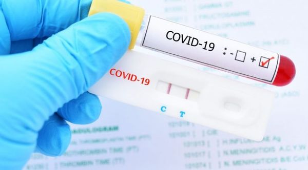 Suman más de 1.000 casos de COVID-19 en las últimas 24 horas y confirman otros 17 fallecidos