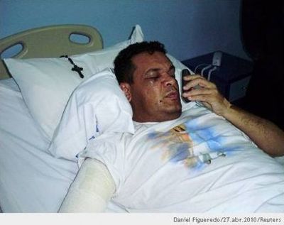 Urgente: Robert Acevedo continua en condición crítica