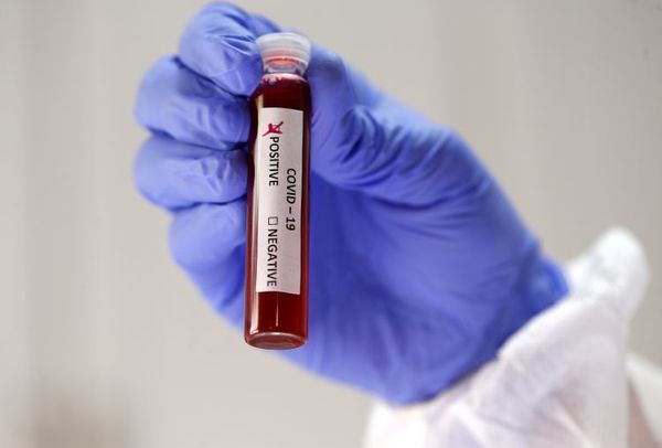Salud reporta 18 muertes y 1.121 nuevos contagios de Covid-19