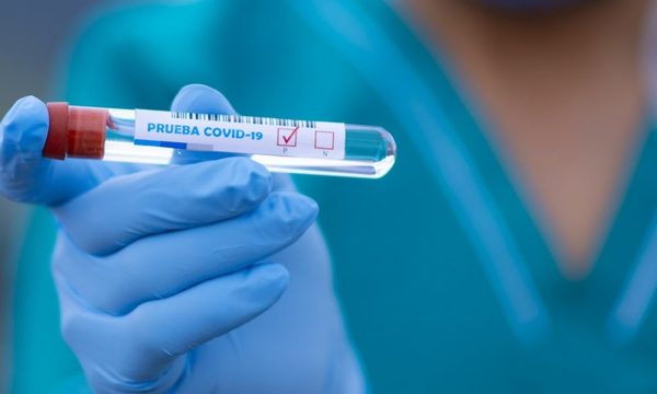 Coronavirus deja 18 fallecidos en Ñande Retá