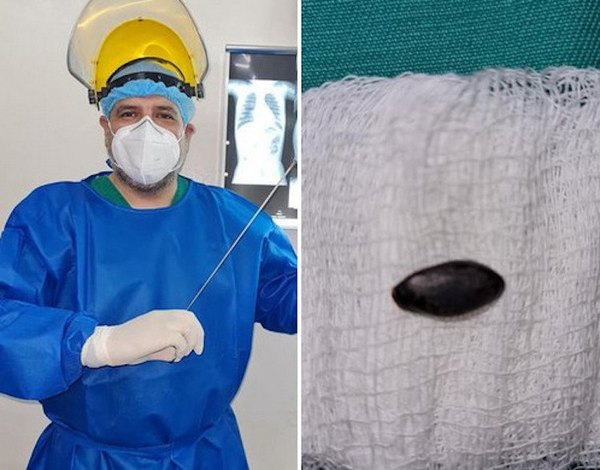 Crónica / Bebita tragó semilla y fue salvada de milagro
