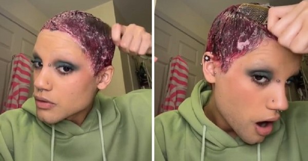 Influencer pide donaciones para una cirugía luego de echarse pegamento en el pelo por “error” - C9N