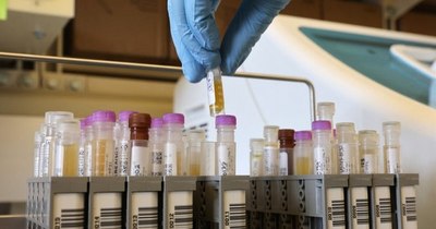 La Nación / COVID-19: Salud confirma primer caso de reinfección en Paraguay