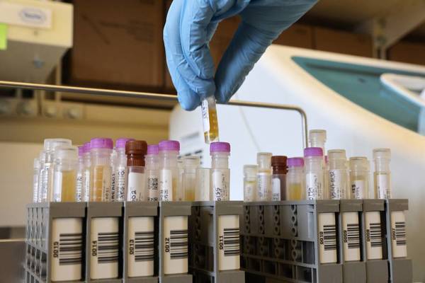 COVID-19: SALUD CONFIRMA PRIMER CASO DE REINFECCIÓN EN PARAGUAY