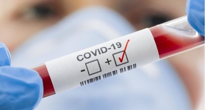Récord contagios: Salud reportó más de 1.300 casos positivos de Covid-19