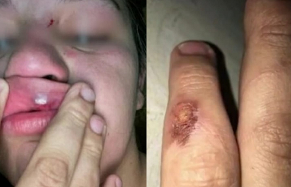 Mujer desesperada denuncia amenazas de muerte por parte de su expareja - Noticiero Paraguay