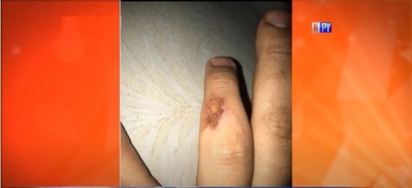 Joven madre víctima de violencia teme por su vida | Noticias Paraguay