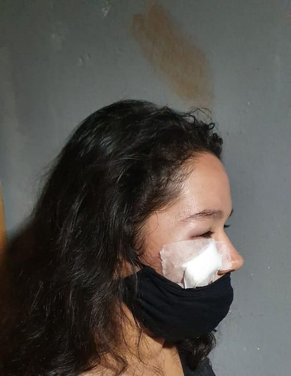 Detienen a hombre que desfiguró a golpes el rostro de su pareja - ABC en el Este - ABC Color