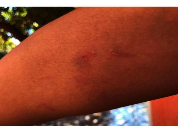 Joven madre, golpeada por tercera vez