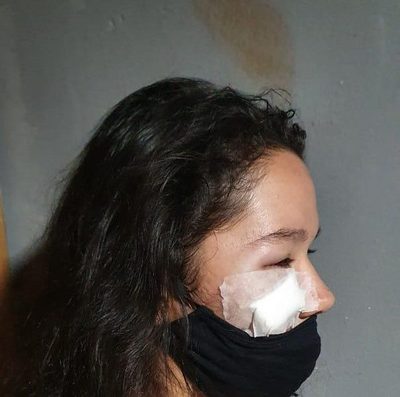 Hombre desfiguró a puños el rostro de su pareja