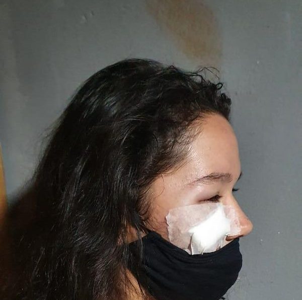 Hombre desfiguró a puños el rostro de su pareja
