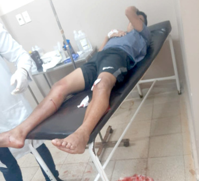 Joven es baleado en ambas piernas durante presunto ajuste de cuentas