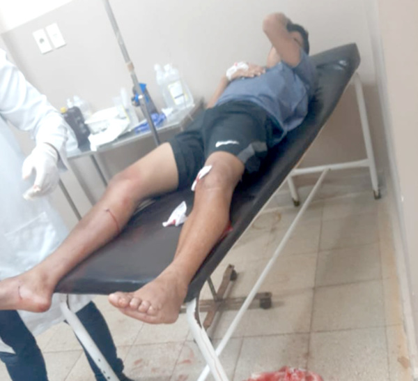 Joven es baleado en ambas piernas durante presunto ajuste de cuentas
